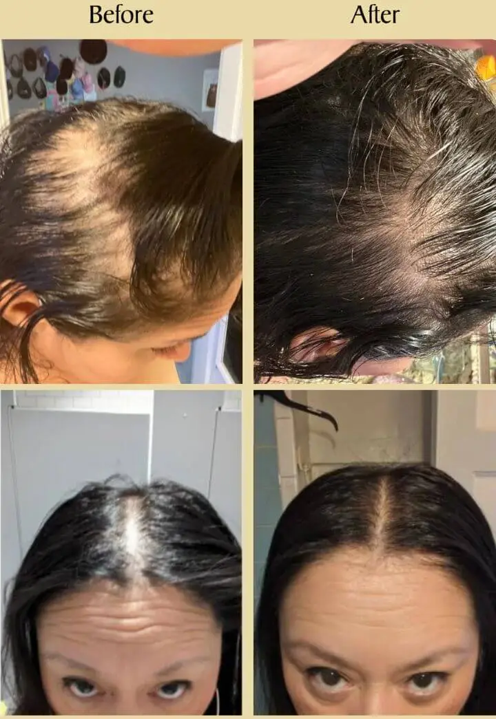 Veganic Natural Hair Growth Oil